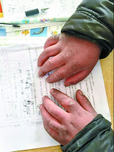 "冰花男孩"获暖冬补助 爱心善款已超30万元(图)